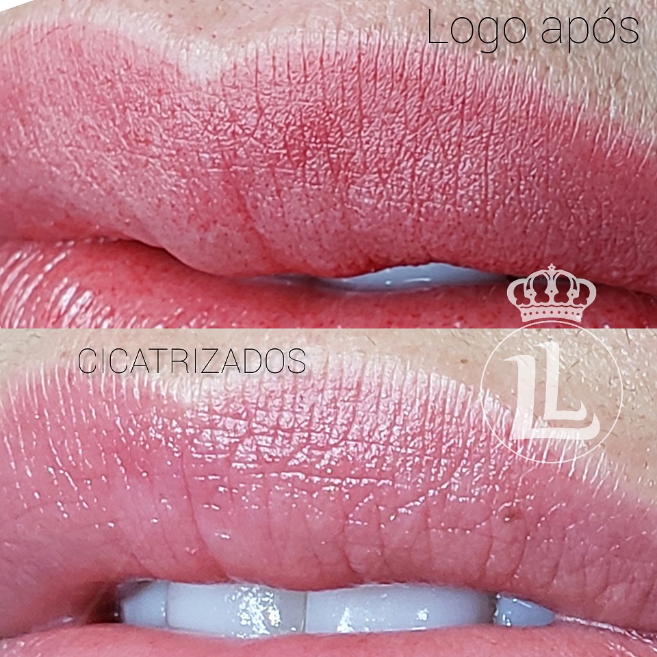 Micropigmentação labial