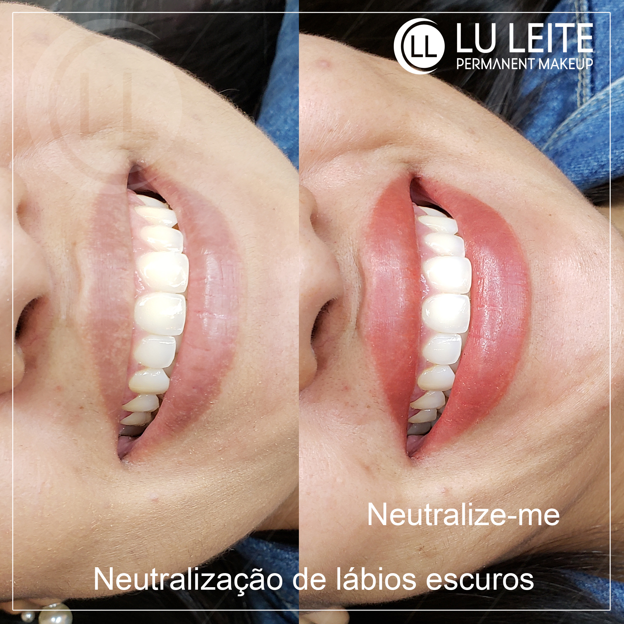 Neutralização labial