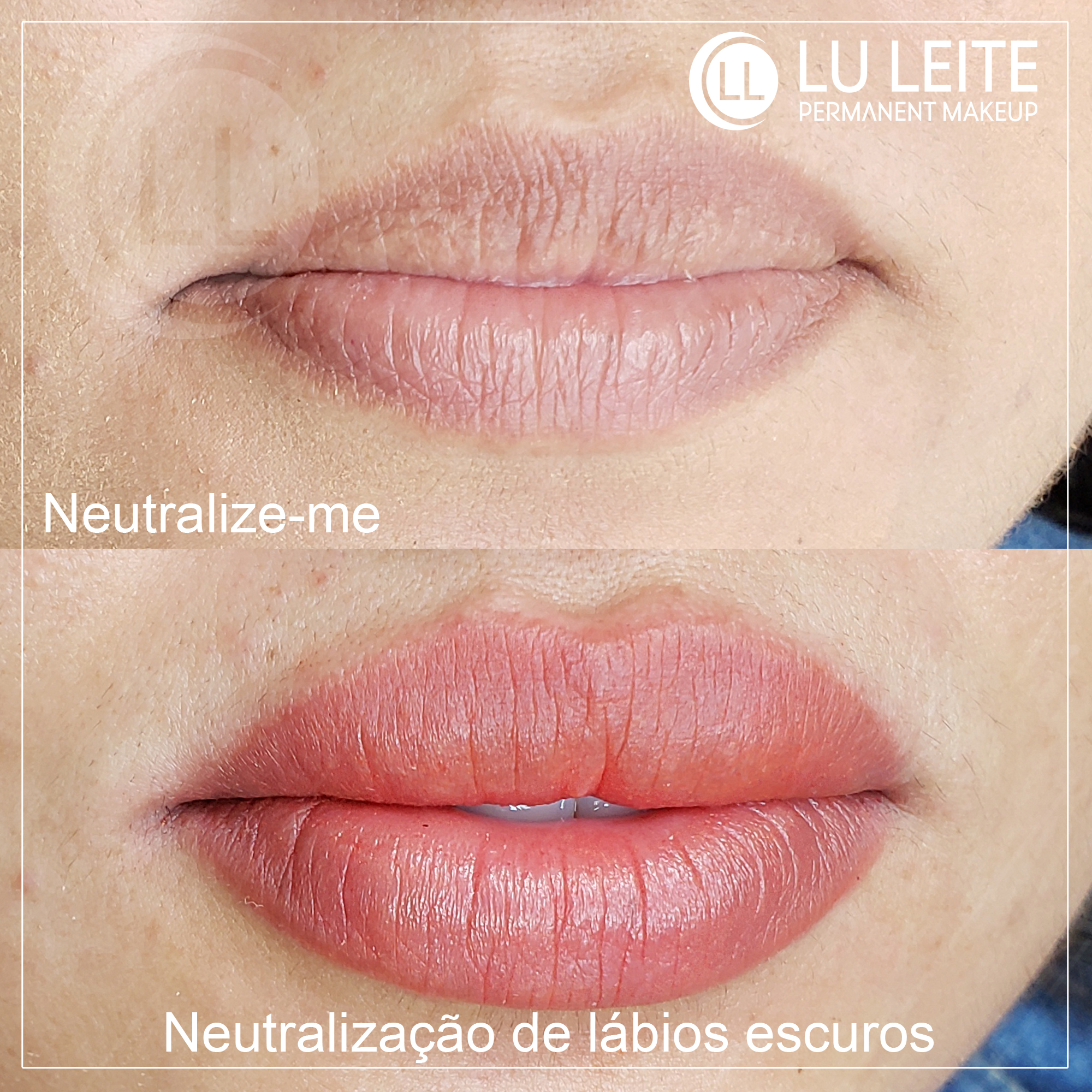 Neutralização labial