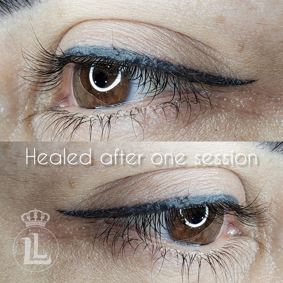 Delineado softliner
