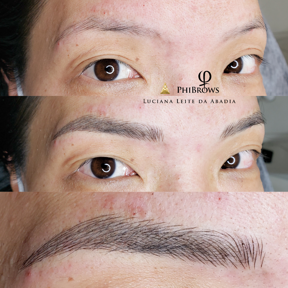 Antes e depois