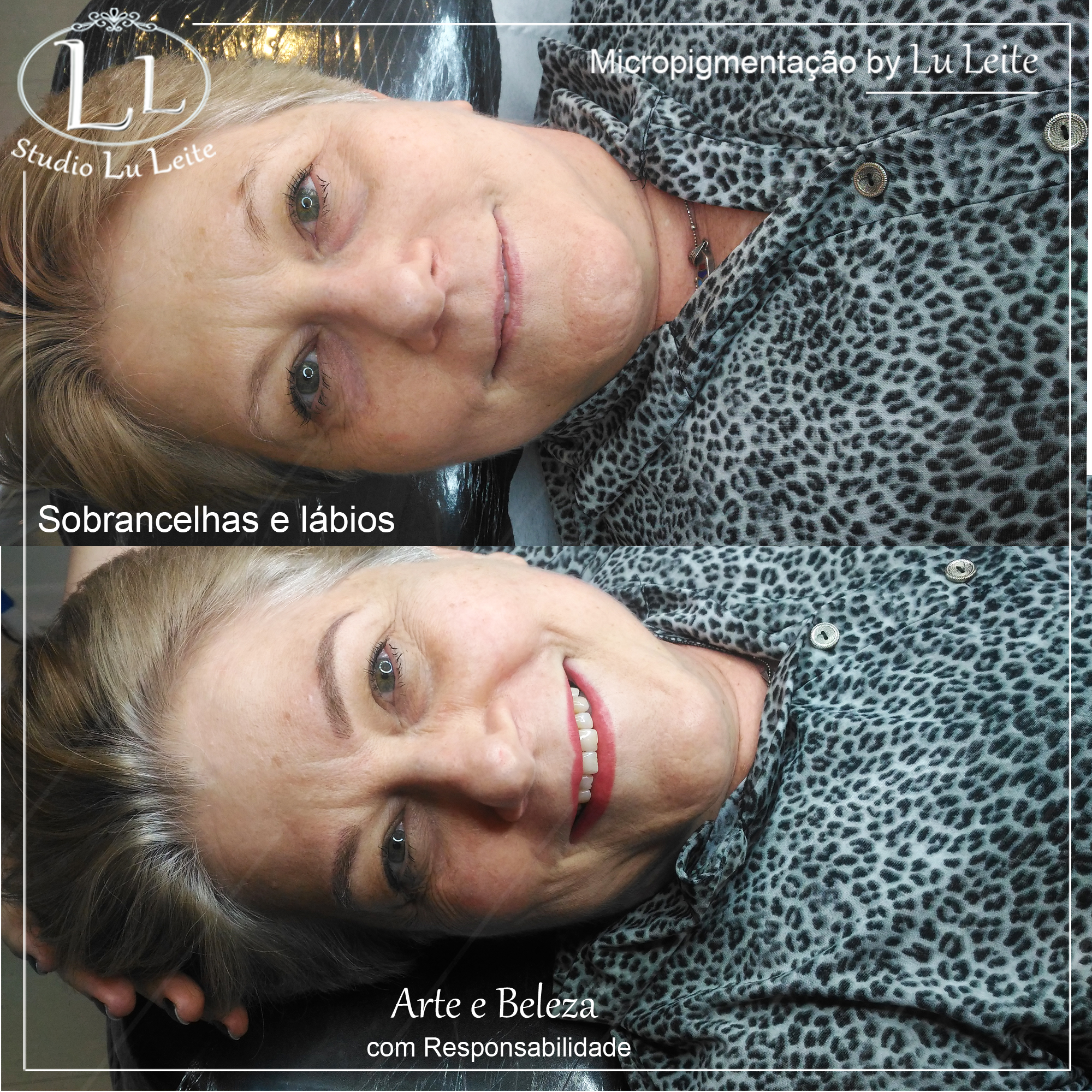 Antes e depois